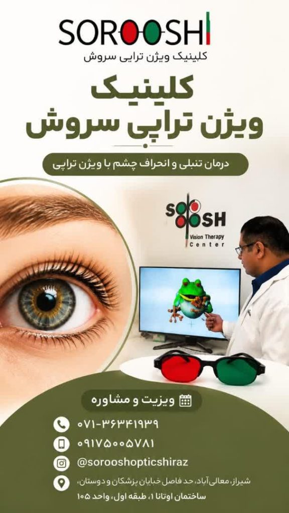 مشاوره درمان تنبلی و انحراف چشم